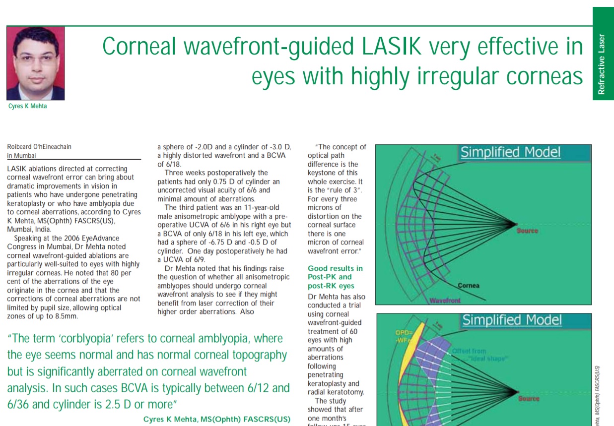 Corneal wavefront-guided LASIK very effective in eyes with highly irregular corneas